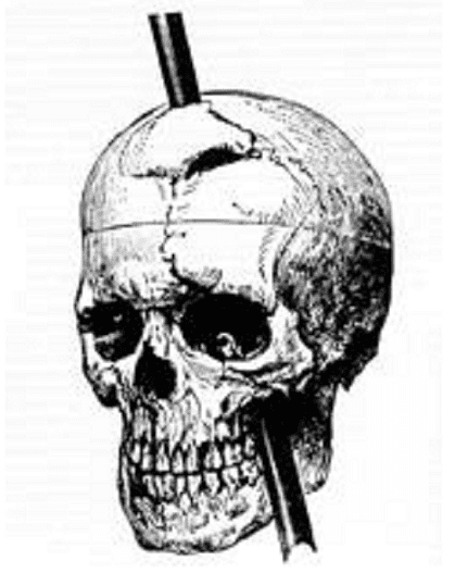 Illustration: skull diagram of Phineas P. Gage showing the path of the iron bar, 1868